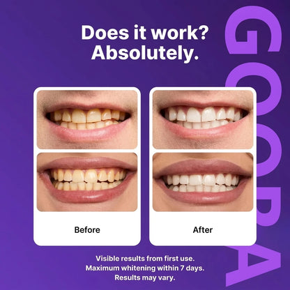 GOORA® Purple  Teeth Whitening Strips